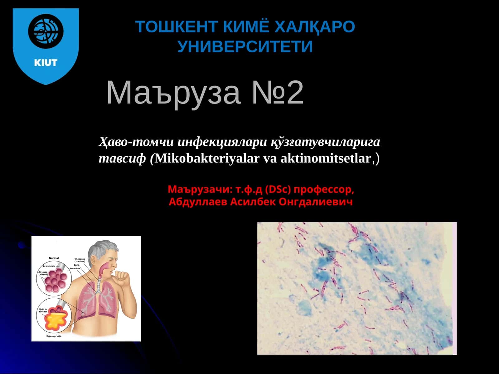 Ҳаво-томчи инфекциялари қўзғатувчиларига тавсиф (Mikobakteriyalar va aktinomitsetlar)