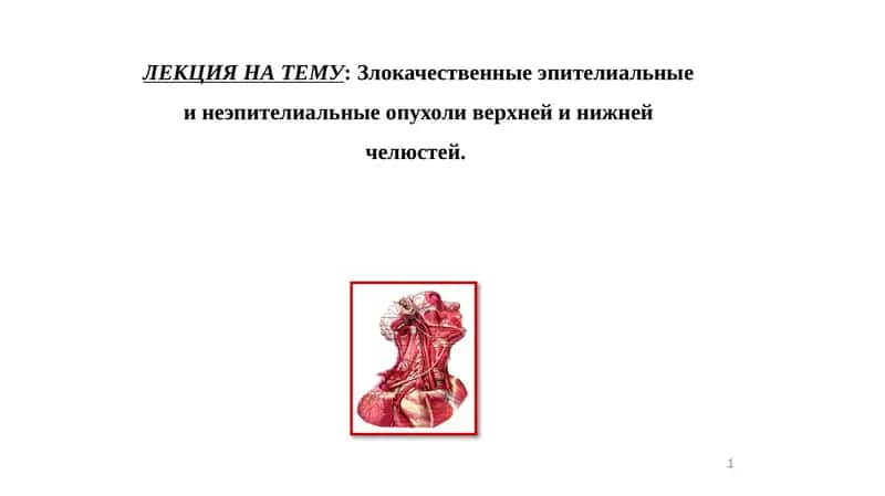 Злокачественные эпителиальные инеэпителиальныеопухоли верхней и нижней челюстей