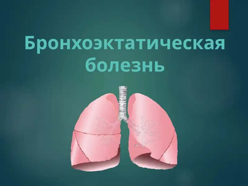 БРОНХОЭКТАТИЧЕСКАЯ БОЛЕЗНЬ