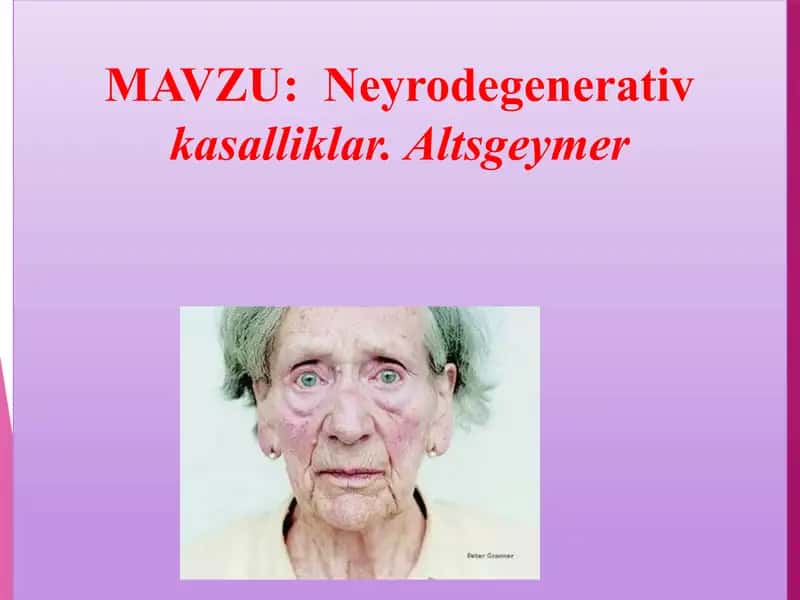 Altsgeymer