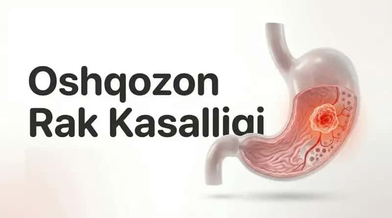 Oshqozon rak kasalligi