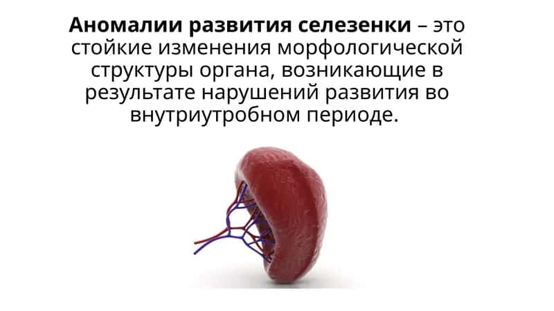Аномалии развития селезенки