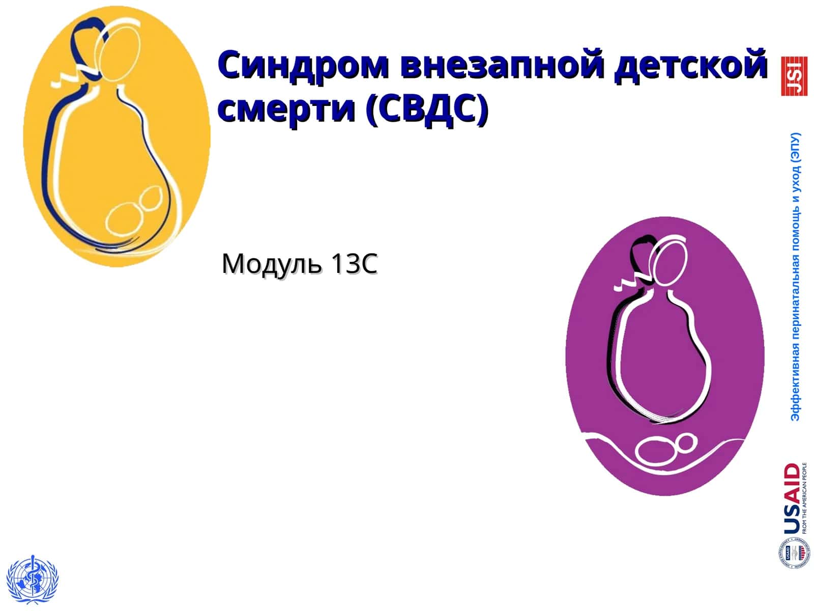 Синдром внезапной детской смерти(СВДС)