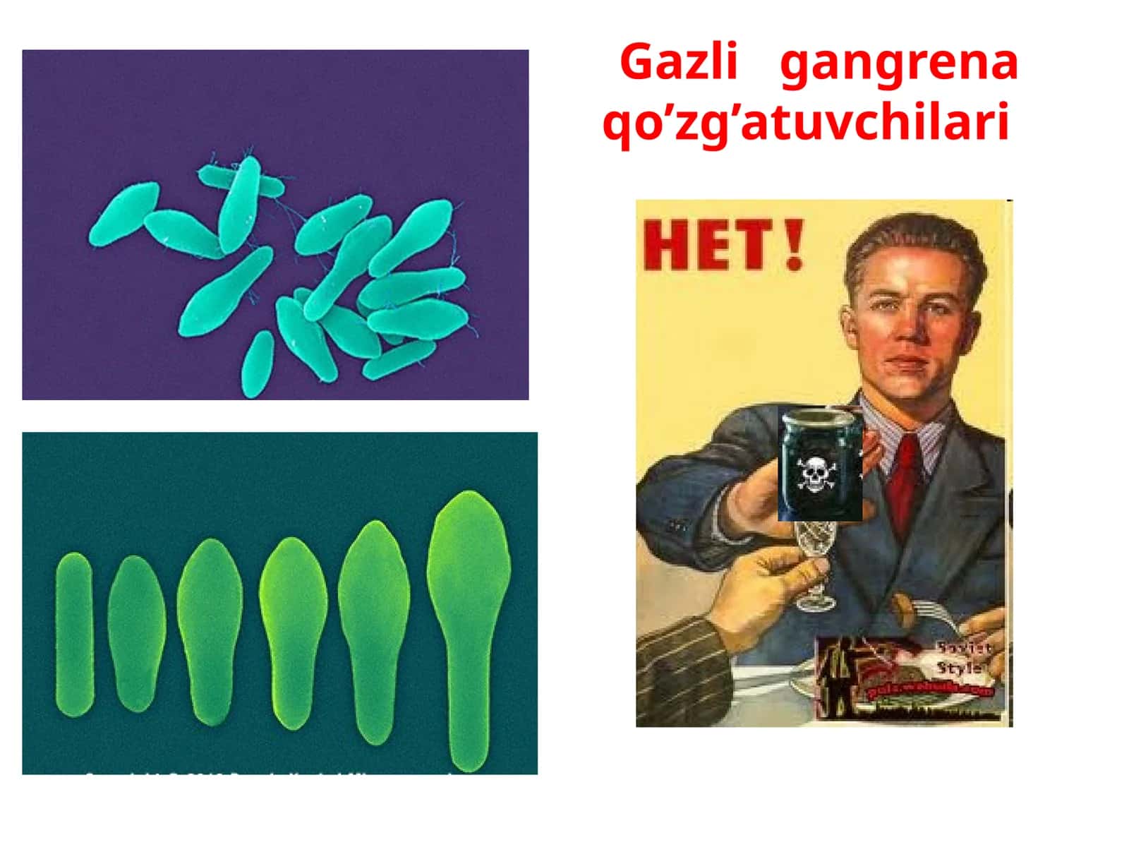 Gazligangrena qo’zg’atuvchilari