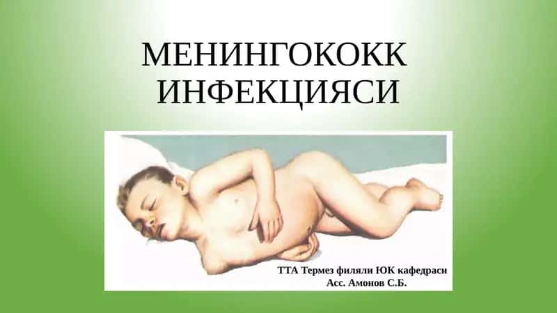 МЕНИНГОКОКК ИНФЕКЦИЯСИ