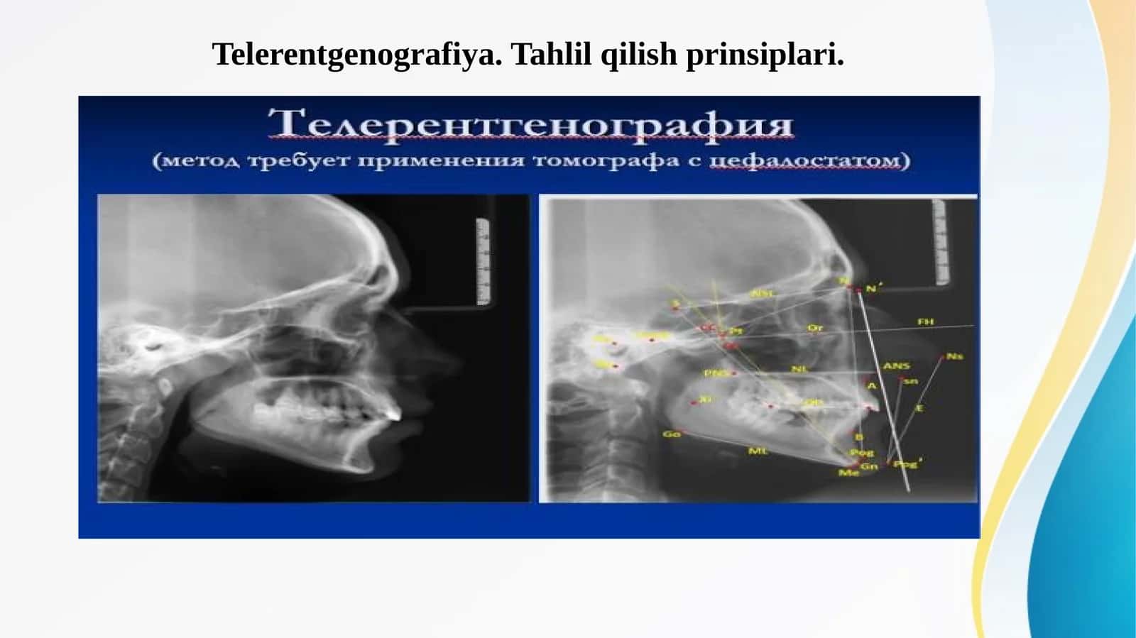 Telerentgenografiya. Tahlil qilish prinsiplari. Телерентгенография. Тахлил килиш принцплари