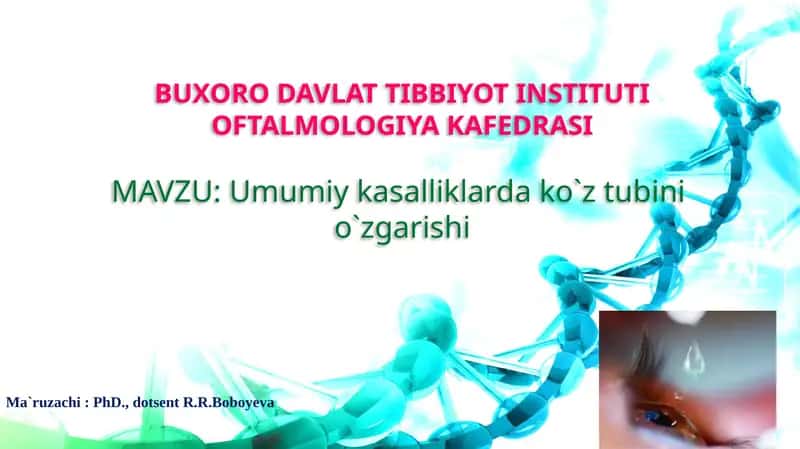 Umumiy kasalliklarda ko`z tubinio`zgarishi