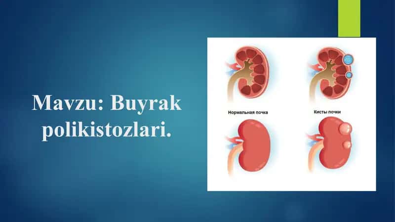 Buyrakpolikistozlari
