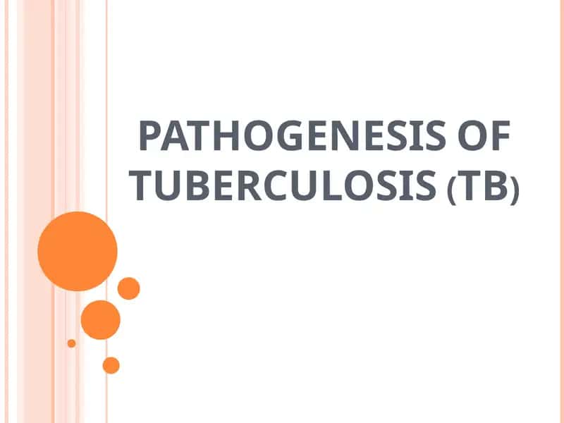 Pathogenesis of Tuberculosis (TB)