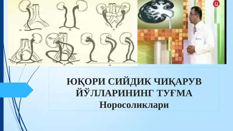 ЮҚОРИ СИЙДИК ЧИҚАРУВ ЙЎЛЛАРИНИНГ ТУҒМАНоросоликлари