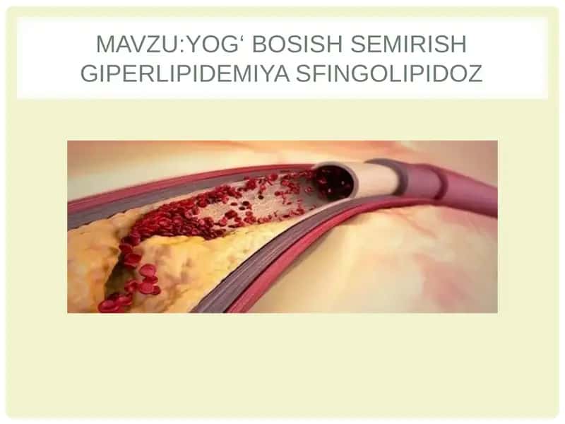 Sfingolipidozlar