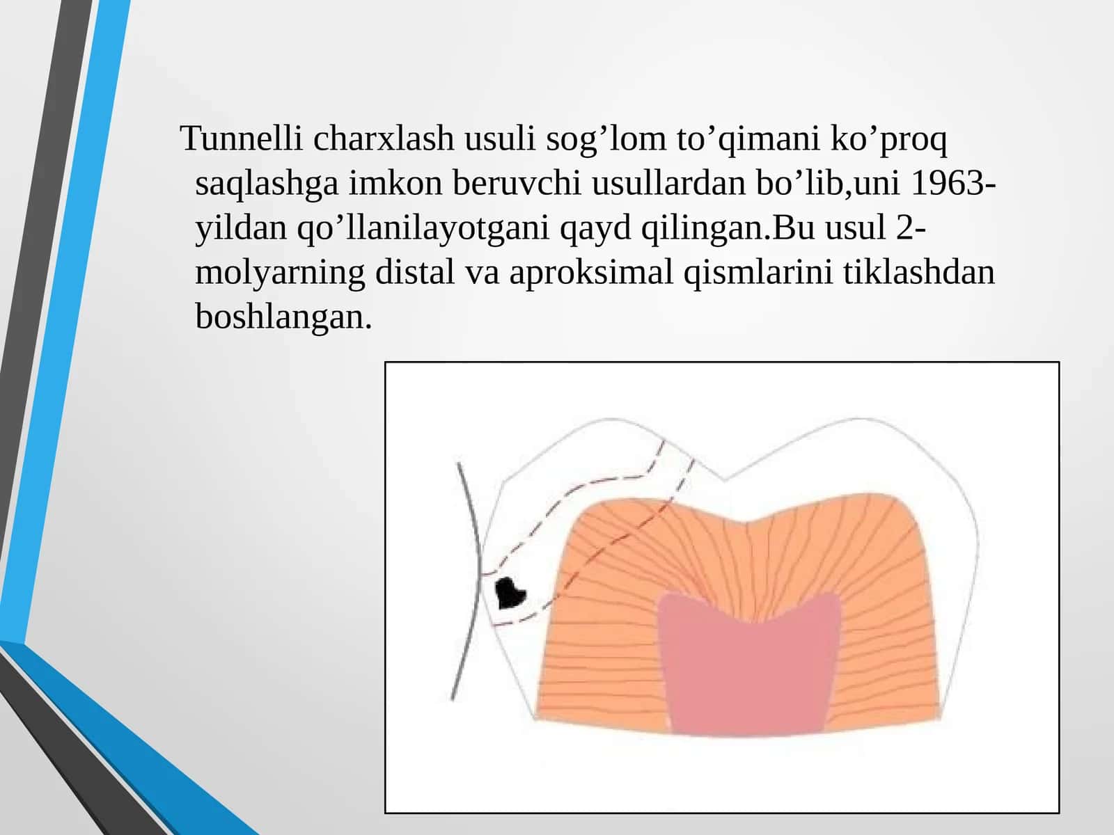 Tunnelli charxlash usuli